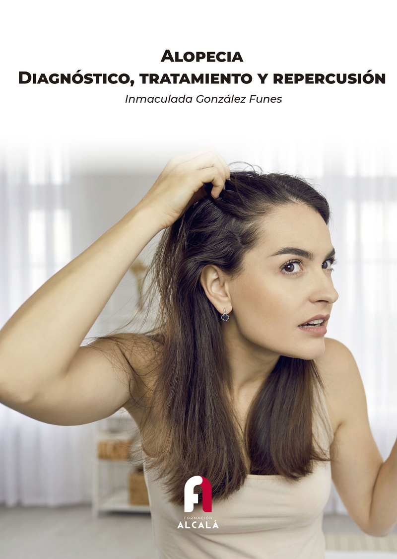 ALOPECIA. DIAGNÓSTICO, TRATAMIENTO Y REPERCUSIÓN: portada